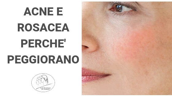 perchè acne e rosacea peggiorano